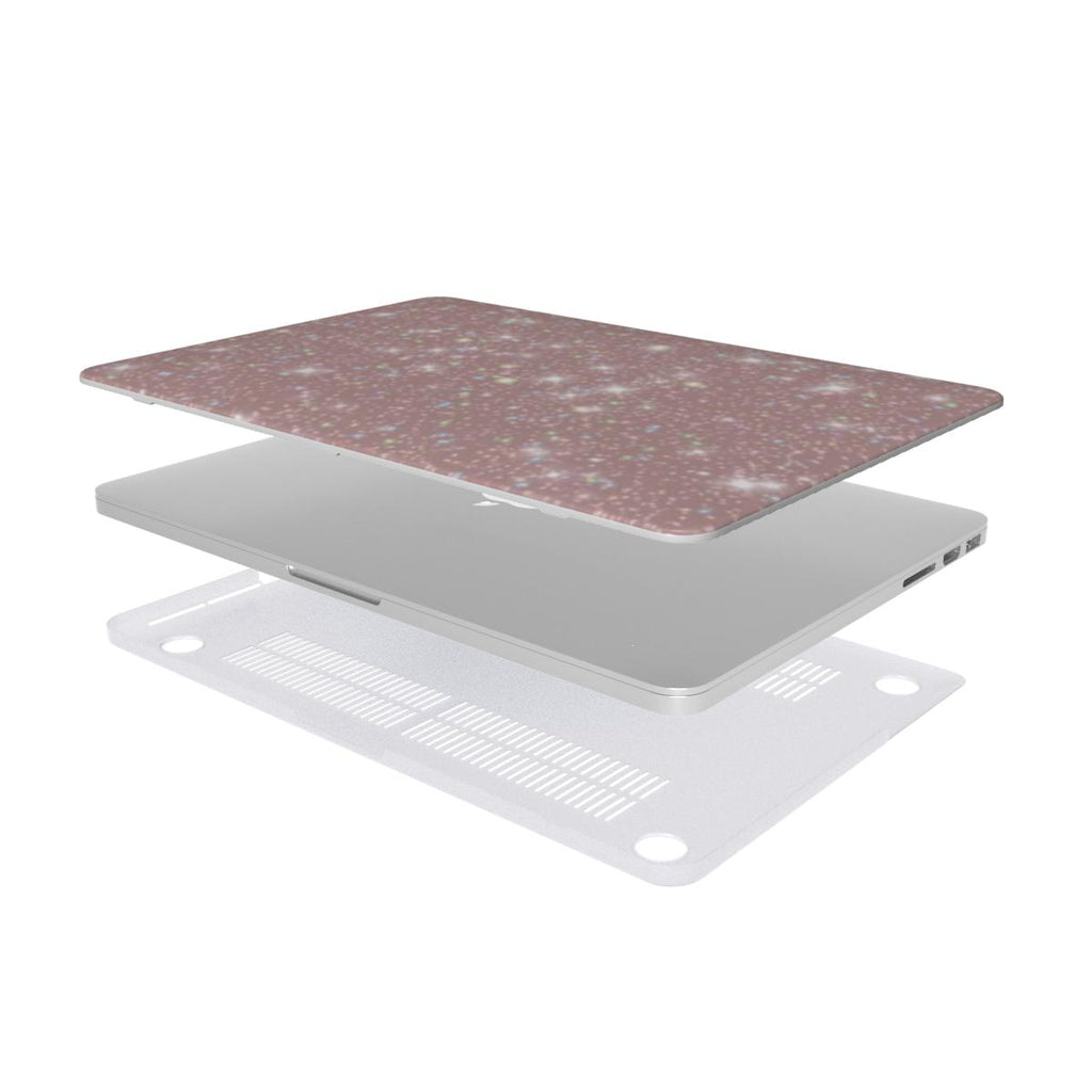Pink Sparkle MacBook Case