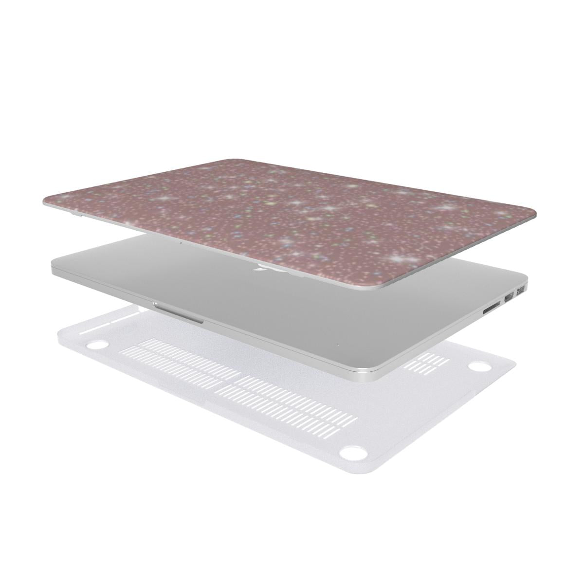 Pink Sparkle MacBook Case