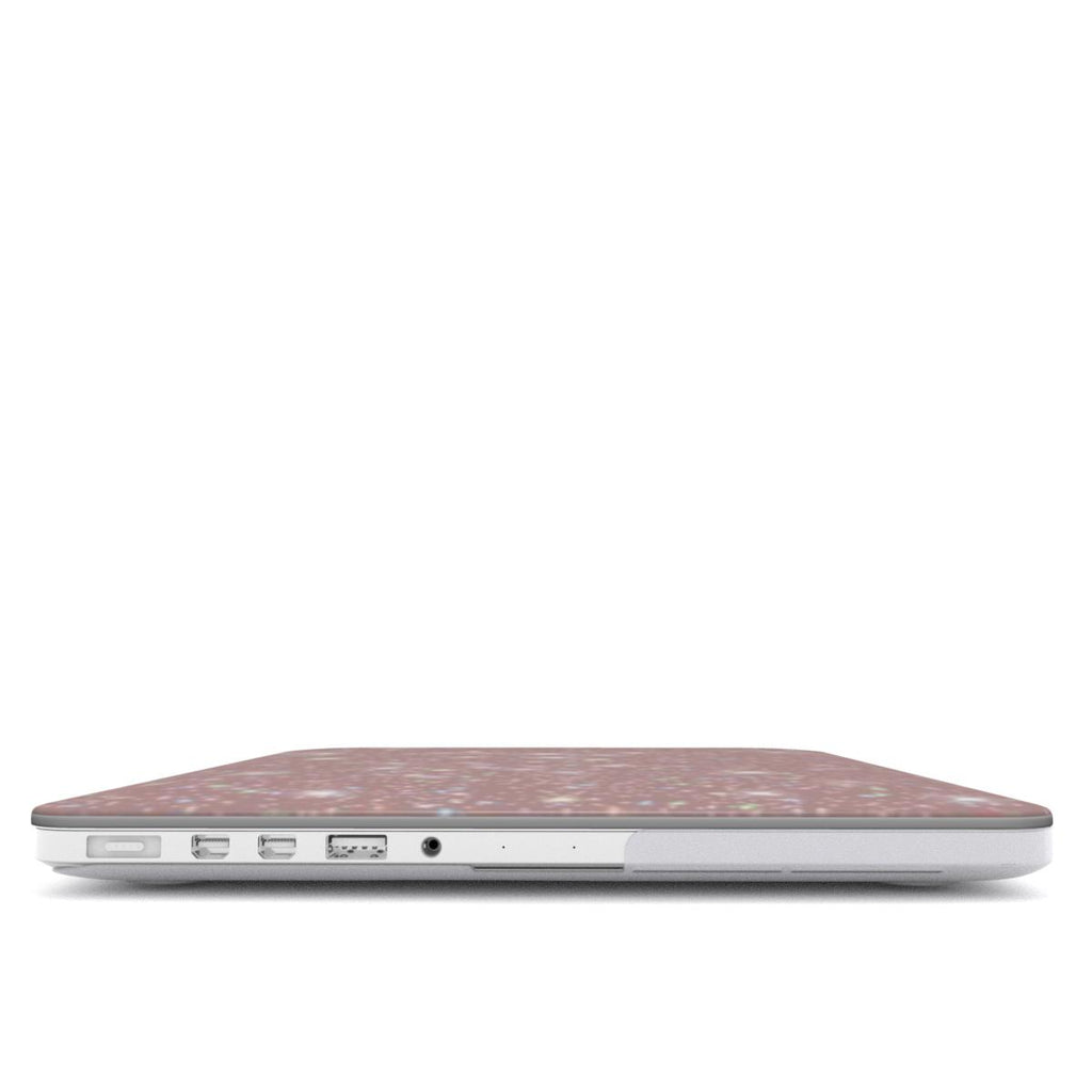 Pink Sparkle MacBook Case