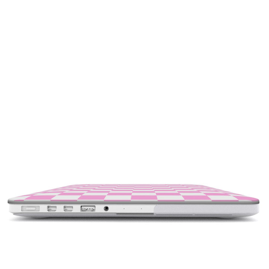 Ballet Check MacBook Case
