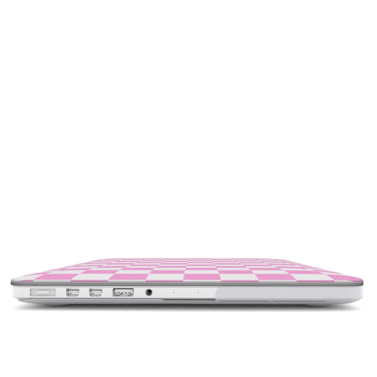 Ballet Check MacBook Case