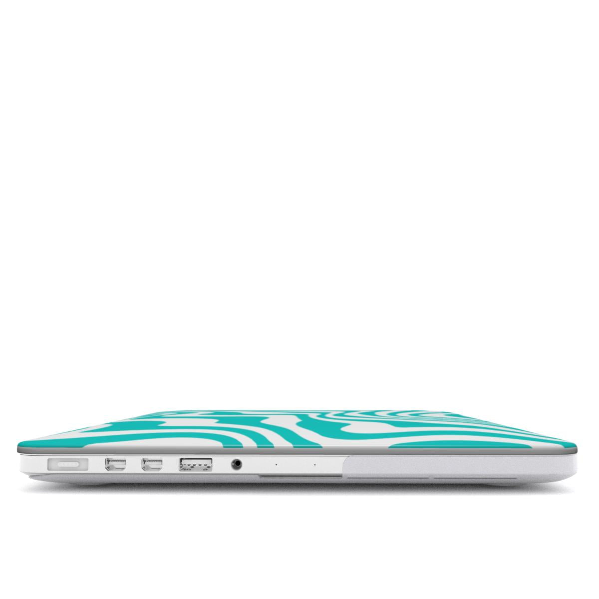 Electric Teal MacBook Case