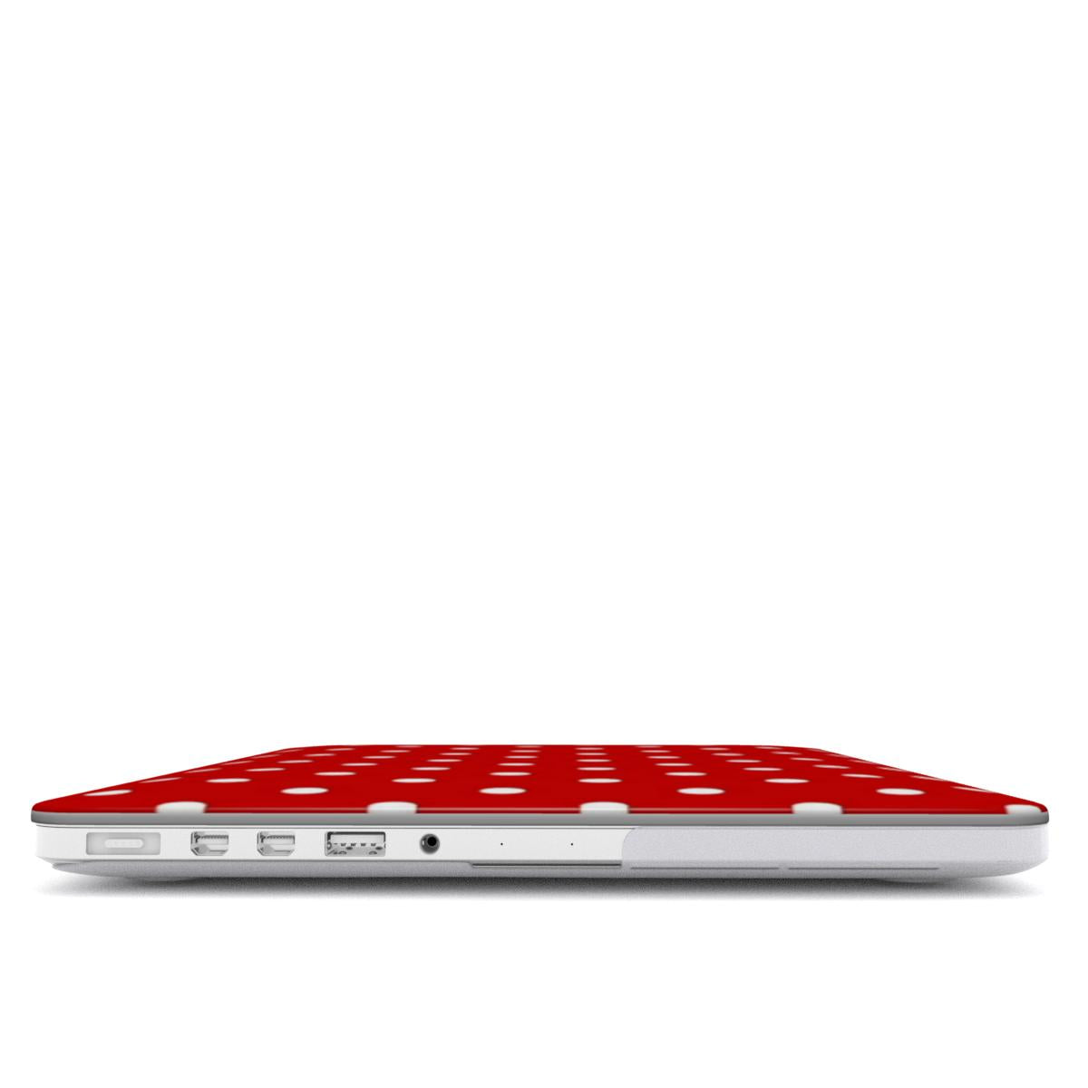 Cherry Cream MacBook Case