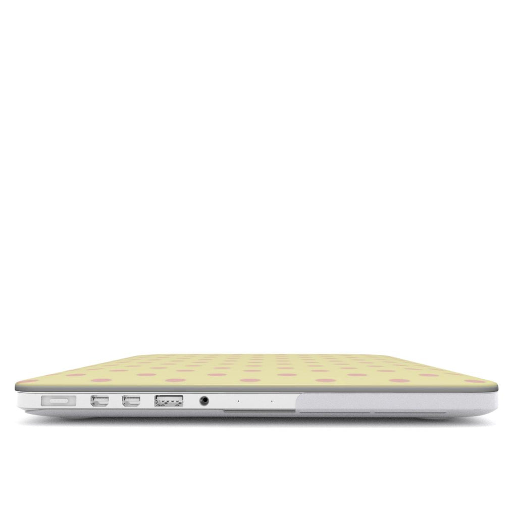 Morning Sorbet MacBook Case