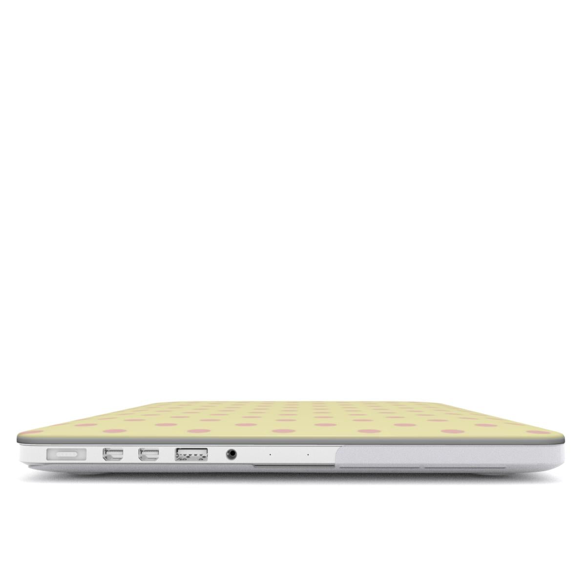 Morning Sorbet MacBook Case